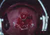 AIDED VISUAL INSPECTION OF THE CERVIX 16 MII16.jpg (52756 octets)