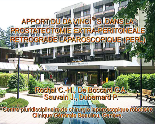 Apport du "da Vinci" dans la prostatectomie extra-péritonéale rétrograde laparoscopique (PERL) - Charles-Henry Rochat, Georges-Antoine de Boccard, Jean Sauvain, Pierre Dubernard