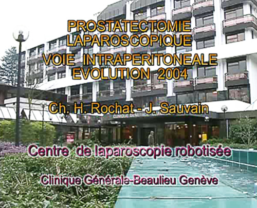 Prostatectomie laparoscopique / Laparoscopic prostatectomy - Charles-Henry Rochat, Jean Sauvain