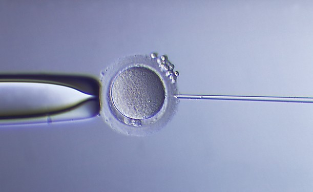 Fécondation in vitro et ICSI