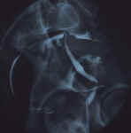 myome_1b.jpg (35652 octets)