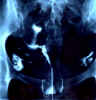 uterus_DES_1c.jpg (28033 octets)