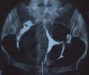 myome_1a.jpg (47250 octets)