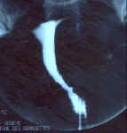 myome_interstitiel1.jpg (59412 octets)