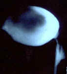 myome_sousmuqueux_5a.jpg (36904 octets)