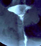 polype2a.jpg (14587 octets)