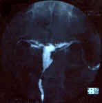 synéchie_1a.jpg (58826 octets)