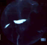 uterus_cloisonne_2a.jpg (44841 octets)