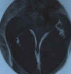 uterus_cloisonne_4a.jpg (24548 octets)