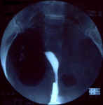 uterus_unicorne_2a.jpg (50279 octets)